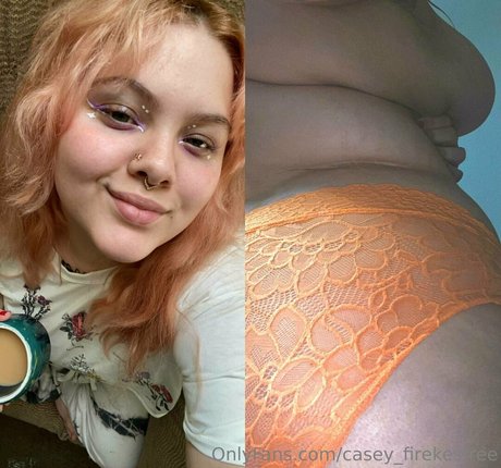 casey firekesfree adult model pic