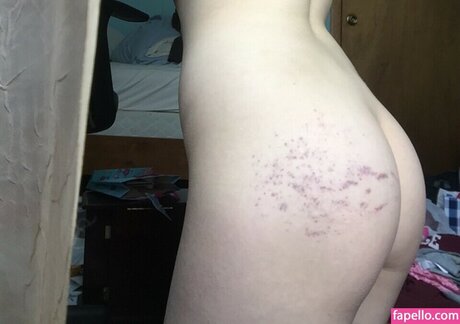 Neoaphrodite thumbnail