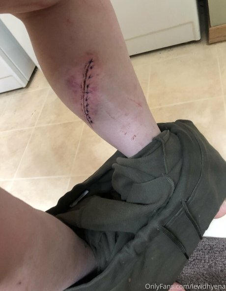 lewdhyena hd star archive