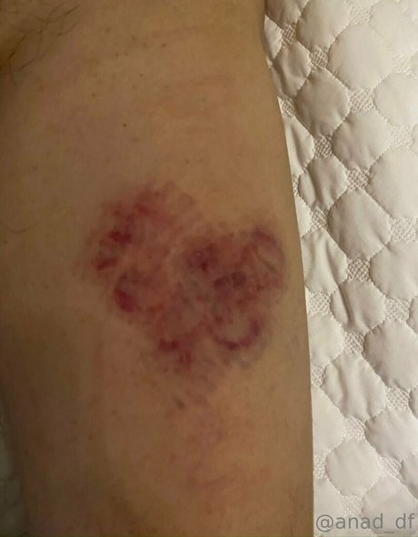 anad df erotische nette galerien