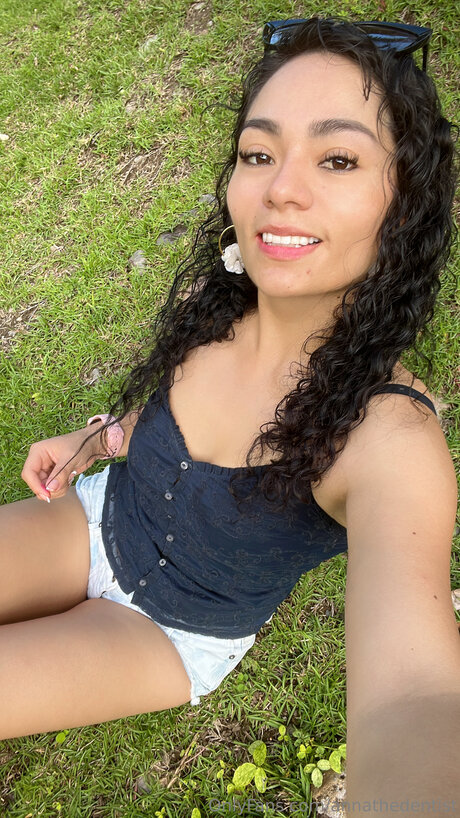 anfällige knochen-onlyfans freie nackten galerie