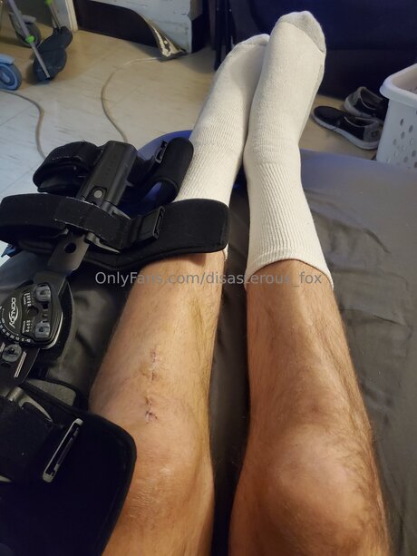 Disasterous Fox kostenlose nackten galerie