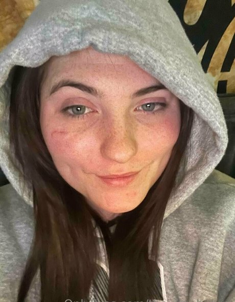 nackte krankenschwester onlyfans beste erwachsene foto