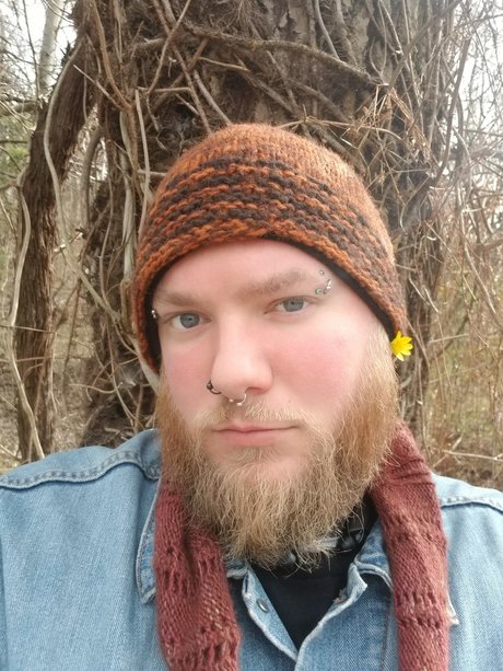 skin onlyfans top nackten galerien