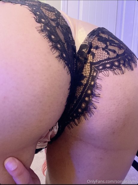 anfällige knochen-onlyfans nackt hübsche fotos