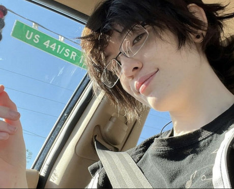 Lobotomite beste nette galerie