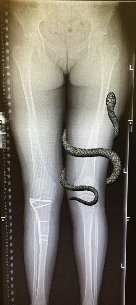 grungifungifree erwachsene kostenlose galerien