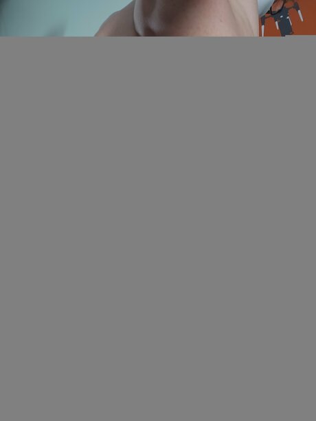 Fox Backyard exklusive beste foto