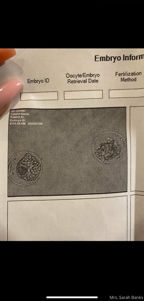 schönes gesicht nur fans kunst pornographische galerien