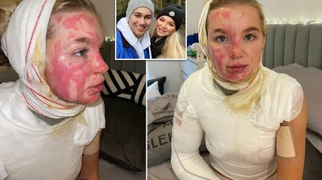 fetisch-onlyfans nackt top galerien