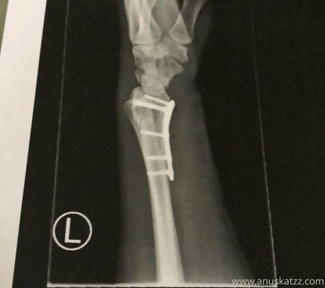 schöne füße nur fans erwachsene nacktheit bilder