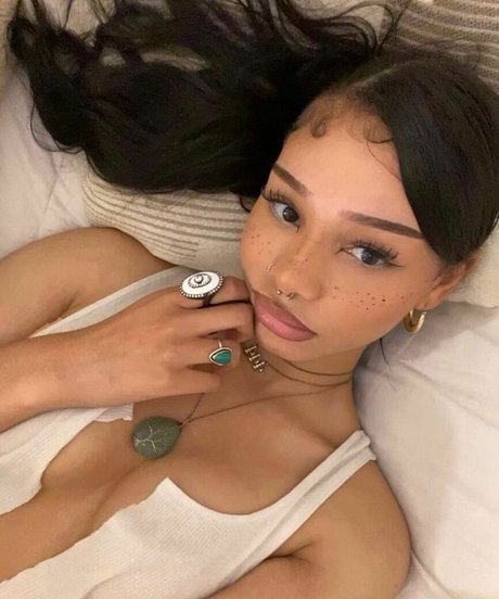 Oirpacid kostenlose top galerie