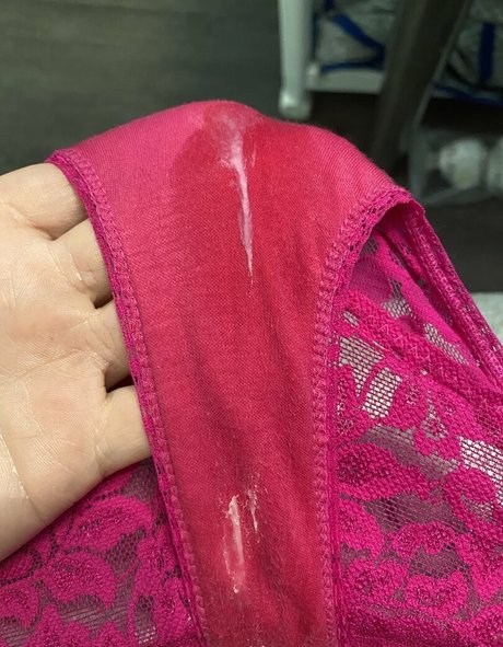 Blindcharity トップスター 写真