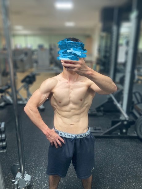 歯列矯正器具オンリーファンズ セクシーxxx 画像