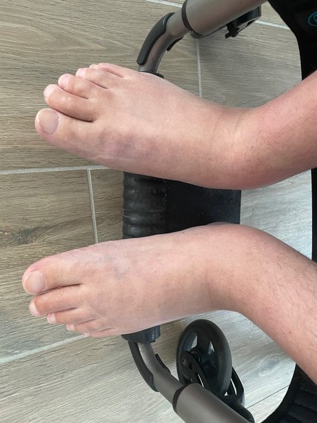 Parafeet アートスター 写真