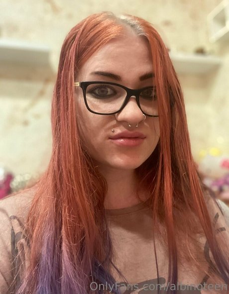 albinoteen 完璧なポルノスター 写真