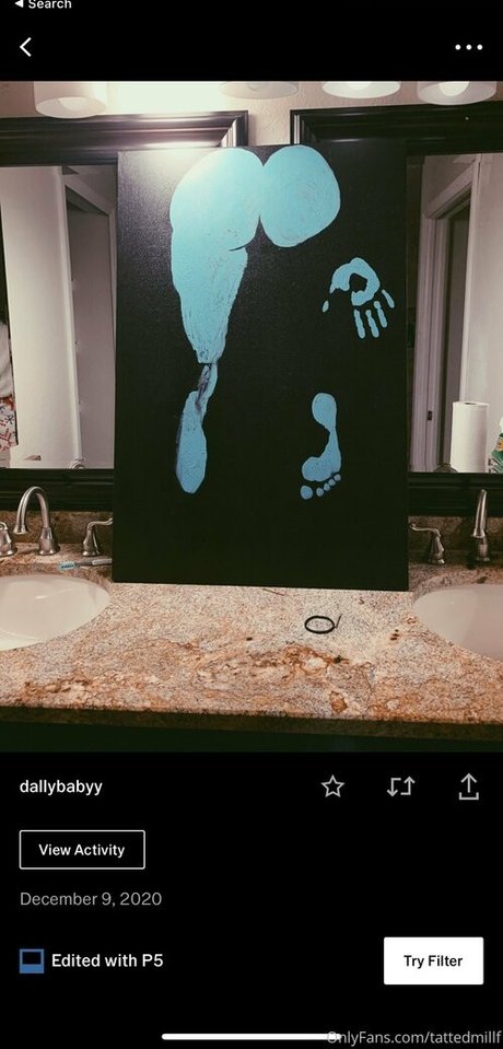 dallybaby HDスター 写真