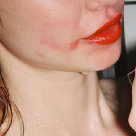 Herbert Twins エロティックなスター ギャラリー