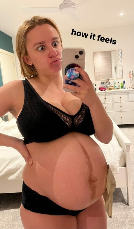 Hannah Witton ヌードモデル 写真